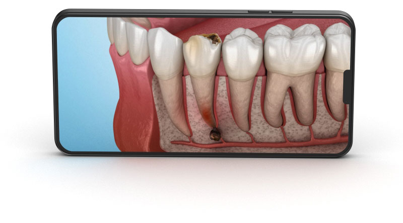 You will find next categories