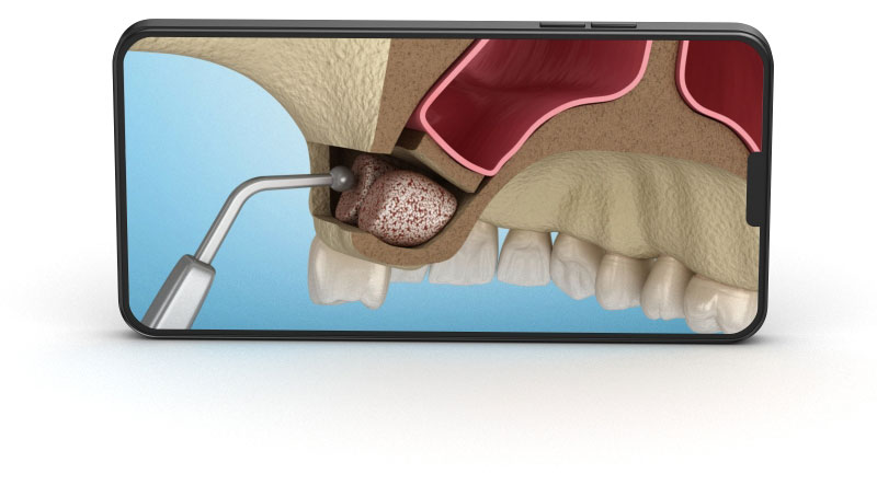 You will find next categories