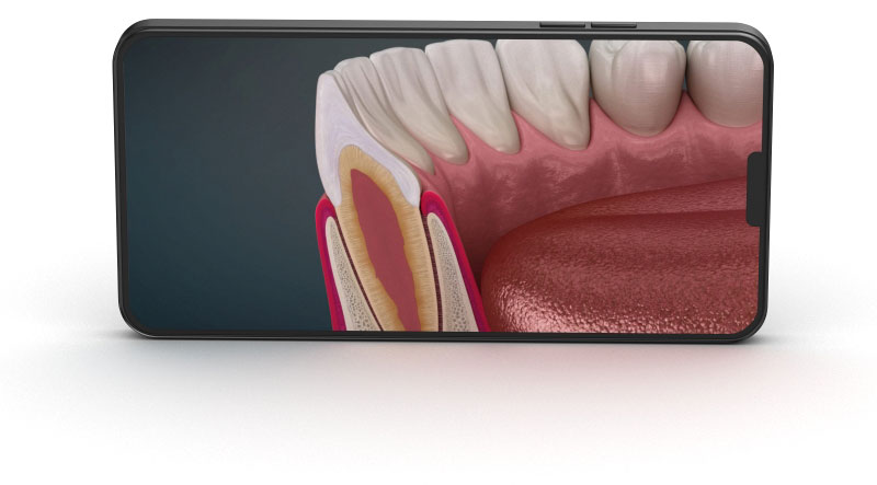 You will find next categories