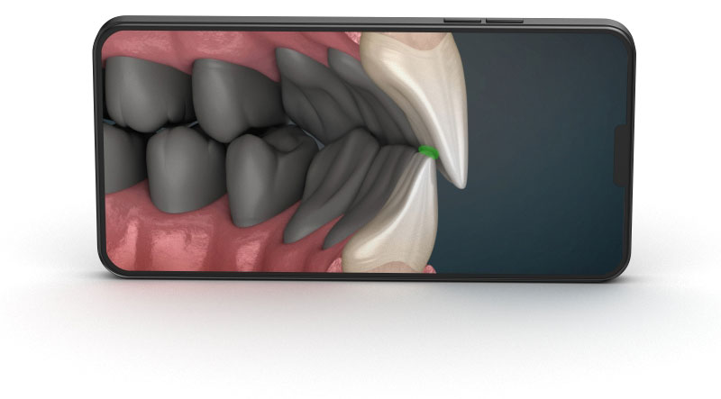 You will find next categories