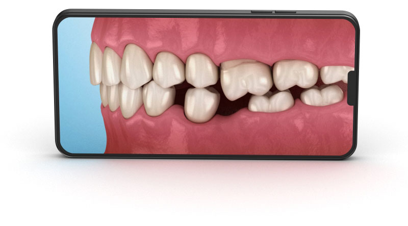 You will find next categories