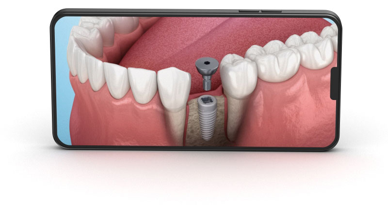 You will find next categories