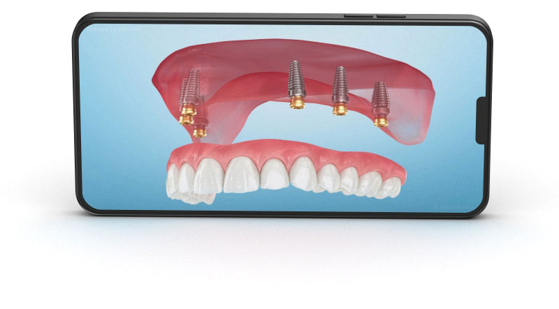 You will find next categories